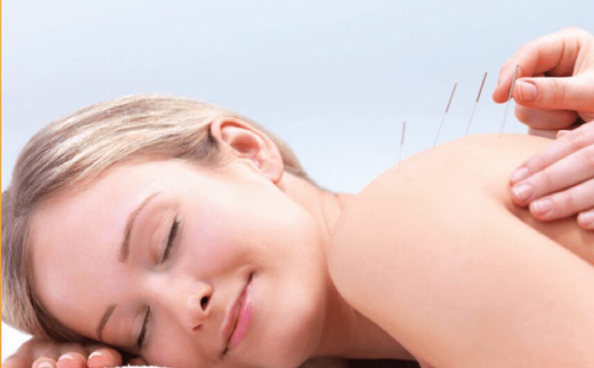 woman-receiving-acupuncture